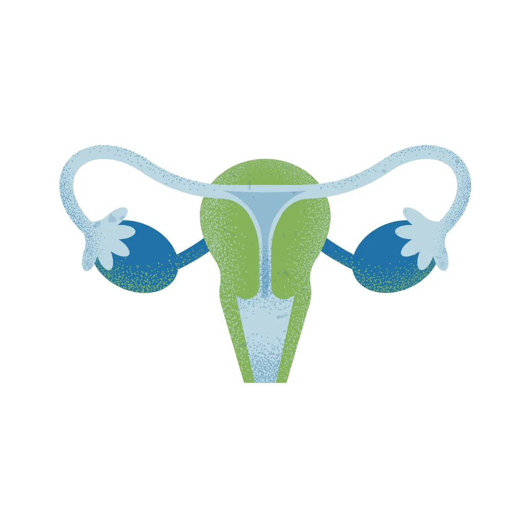 PCOS